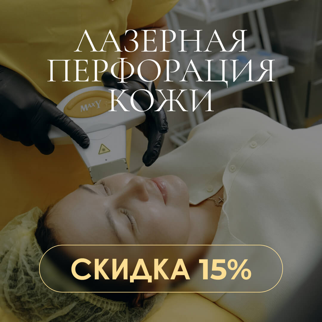 Лазерная перфорация кожи — скидка 15%